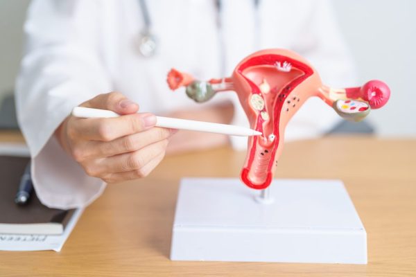 Hysterectomy
