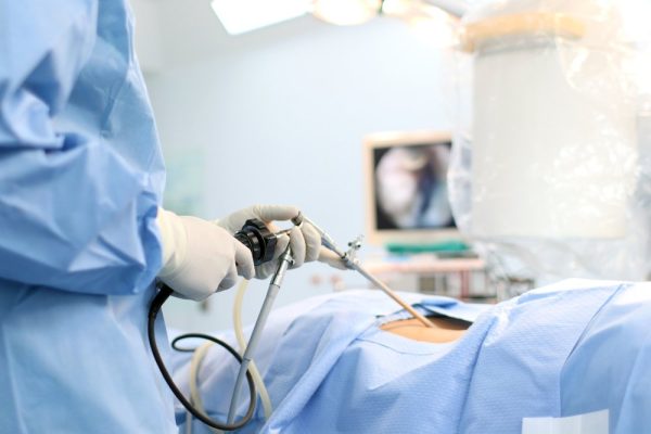 Laparoscopic Treatment